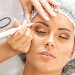 PMU Nachbehandlung nach einem Jahr