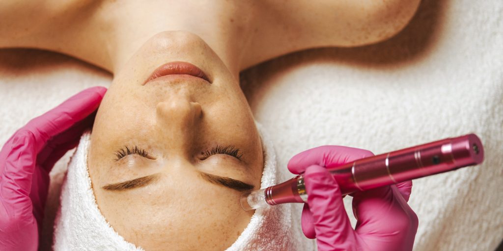 Microneedling