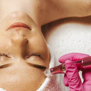 Microneedling